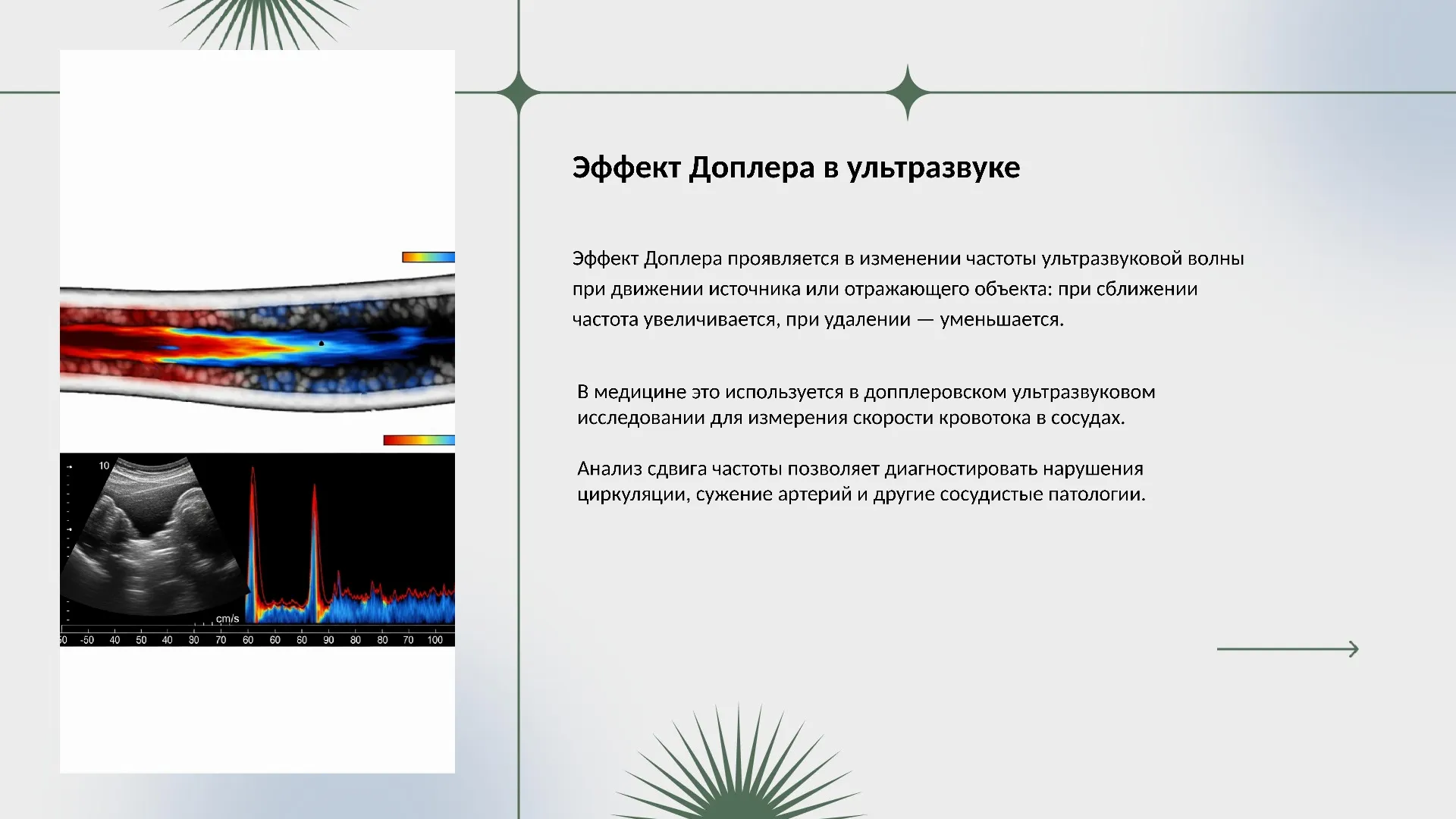 Эффект Доплера в ультразвуке
